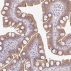 Immunohistochemical staining of human small intestine shows moderate granular cytoplasmic positivity in glandular cells.