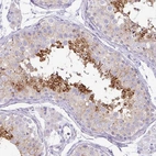 Immunohistochemical staining of human testis shows strong granular cytoplasmic positivity in cells in seminiferous ducts.