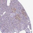Immunohistochemical staining of human pancreas shows moderate cytoplasmic positivity in islets of Langerhans.