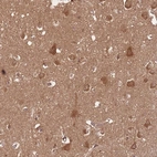 Immunohistochemical staining of human cerebral cortex shows moderate membranous and cytoplasmic positivity in neuronal cells.