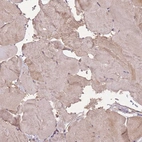 Immunohistochemical staining of human skeletal muscle shows weak positivity in myocytes as expected.