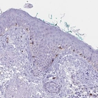 Immunohistochemical staining of human skin shows moderate granular cytoplasmic positivity in melanocytes.