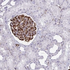 Immunohistochemical staining of human kidney shows strong granular cytoplasmic positivity in cells in glomeruli.