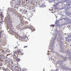 Immunohistochemical staining of human duodenum shows moderate granular cytoplasmic positivity in glandular cells.