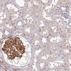 Immunohistochemical staining of human kidney shows strong cytoplasmic positivity in cells in glomeruli.