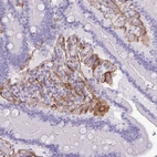 Immunohistochemical staining of human duodenum shows moderate cytoplasmic and membranous positivity in endothelial cells.