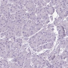 Immunohistochemical staining of human pancreas shows no positivity in exocrine glandular cells as expected.