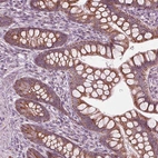 Immunohistochemical staining of human small intestine shows strong granular cytoplasmic positivity in glandular cells.