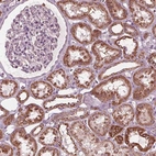 Immunohistochemical staining of human kidney shows strong granular cytoplasmic positivity in cells in tubules.