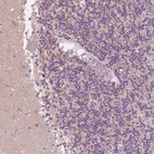 Immunohistochemical staining of human cerebellum shows moderate granular cytoplasmic positivity in cells in granular layer.