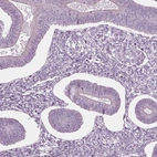 Immunohistochemical staining of human endometrium shows no granular cytoplasmic positivity in glandular cells as expected.