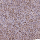 Immunohistochemical staining of human pancreas shows strong granular cytoplasmic positivity in exocrine glandular cells.