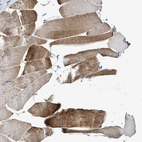 Immunohistochemical staining of human skeletal muscle shows moderate cytoplasmic positivity in myocytes.