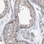 Immunohistochemical staining of human testis shows weak to moderate positivity in a subset of cells in seminiferous ducts.