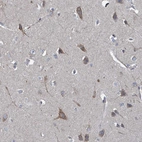 Immunohistochemical staining of human cerebral cortex shows moderate cytoplasmic positivity in neurons.