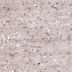 Immunohistochemical staining of human cerebral cortex shows strong cytoplasmic positivity in neuropil.