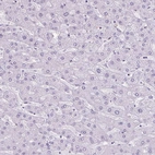 Immunohistochemical staining of human liver shows no cytoplasmic positivity in hepatocytes as expected.