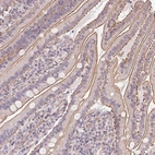 Immunohistochemical staining of human small intestine shows moderate membranous positivity in glandular cells.