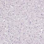 Immunohistochemical staining of human liver shows no positivity in hepatocytes as expected.
