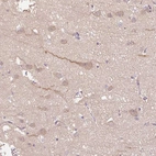 Immunohistochemical staining of human cerebral cortex shows moderate cytoplasmic positivity in neuronal cells.