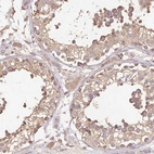 Immunohistochemical staining of human testis shows moderate cytoplasmic positivity in cells in seminiferous ducts.