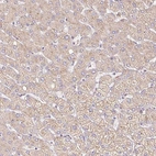 Immunohistochemical staining of human liver shows moderate cytoplasmic positivity in hepatocytes.