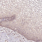Immunohistochemical staining of human cervix, uterine shows moderate cytoplasmic positivity in squamous epithelial cells.