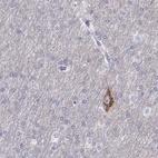 Immunohistochemical staining of human cerebral cortex shows moderate cytoplasmic positivity in neuronal cells.