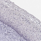 Immunohistochemical staining of human cervix, uterine shows no cytoplasmic positivity in squamous epithelial cells as expected.