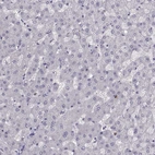 Immunohistochemical staining of human liver shows no cytoplasmic positivity in hepatocytes as expected.