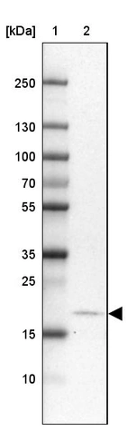 Lane 1: Marker [kDa] 250, 130, 100, 70, 55, 35, 25, 15, 10_br/_Lane 2: Human Cerebral Cortex tissue
