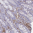 Immunohistochemical staining of human duodenum shows strong cytoplasmic positivity in endothelial cells.