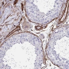 Immunohistochemical staining of human testis shows strong cytoplasmic positivity in endothelial cells.