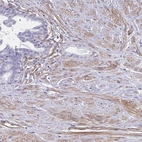 Immunohistochemical staining of human prostate shows moderate cytoplasmic positivity in endothelial cells and smooth muscle cells.