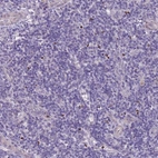 Immunohistochemical staining of human tonsil shows moderate cytoplasmic positivity in leukocytes.