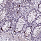 Immunohistochemical staining of human colon shows strong cytoplasmic positivity in enteroendocrine cells.