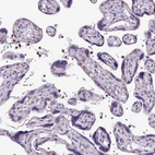 Immunohistochemical staining of human placenta shows moderate cytoplasmic positivity in leukocytes.