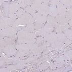 Immunohistochemical staining of human skeletal muscle shows no cytoplasmic positivity in myocytes as expected.