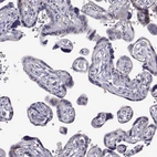 Immunohistochemical staining of human placenta shows no cytoplasmic positivity in trophoblastic cells as expected.