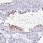 Immunohistochemical staining of human testis shows strong cytoplasmic positivity in subset of cells in seminiferous ducts.