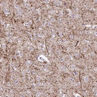 Immunohistochemical staining of human cerebral cortex shows strong cytoplasmic positivity in astrocytes.