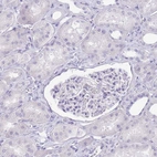 Immunohistochemical staining of human kidney shows no positivity in cells in tubules.