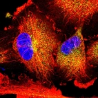 Immunofluorescent staining of human cell line U-251 MG shows localization to vesicles.