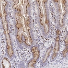 Immunohistochemical staining of human duodenum shows strong membranous positivity in glandular cells with additional cytoplasmic positivity in goblet cells.