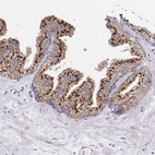 Immunohistochemical staining of human prostate shows strong membranous positivity in glandular cells.
