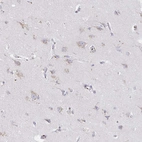 Immunohistochemical staining of human cerebral cortex shows moderate membranous positivity in neurons.