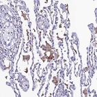 Immunohistochemical staining of human lung shows strong membranous and cytoplasmic positivity in macrophages.