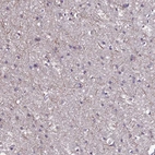 Immunohistochemical staining of human cerebral cortex shows moderate cytoplasmic positivity in neuronal processes.