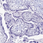 Immunohistochemical staining of human placenta shows no cytoplasmic positivity in trophoblastic cells as expected.
