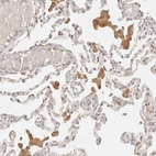 Immunohistochemical staining of human lung shows moderate cytoplasmic positivity in macrophages.